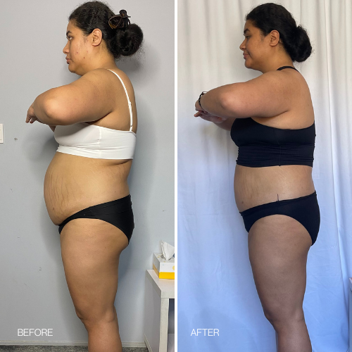 Which Tea Burns Belly Fat Fast? Your Guide to a Slimmer Midsection