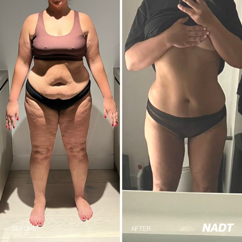 Before & After results 14 day Detox Tea
