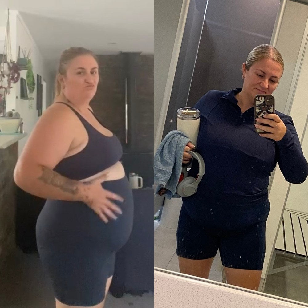 Before and after, Kylie P.