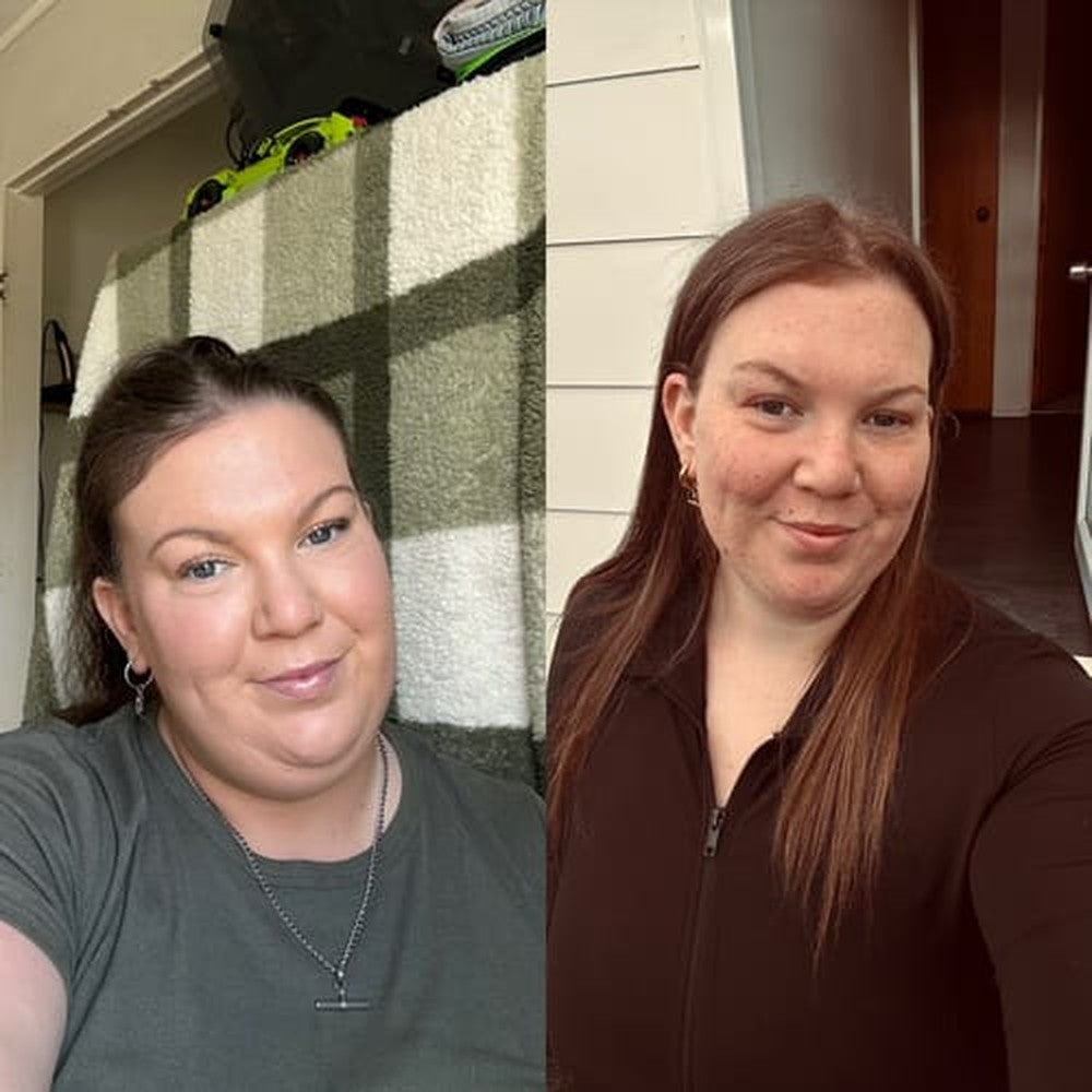 Before and after, Mishada H.