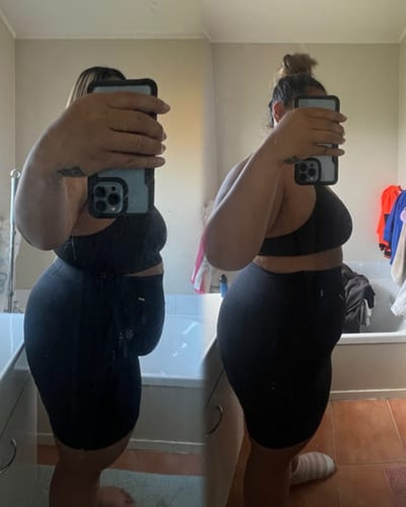 Before and after, Nora S.